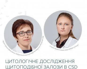 Павліна Боцюн, Наталя Спалєк: Цитологічне дослідження щитоподібної залози в CSD