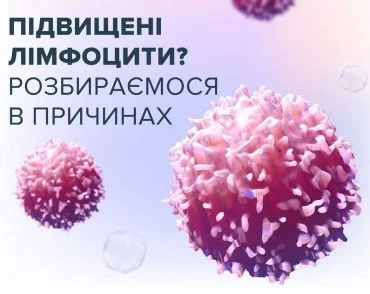 Загальний аналіз крові: підвищені лімфоцити 