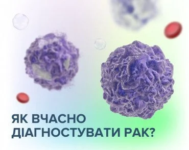 Як вчасно діагностувати рак?