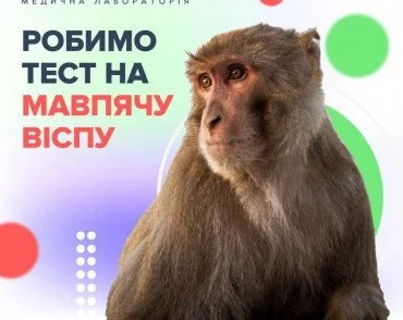 Осторожно! Обезьянья оспа