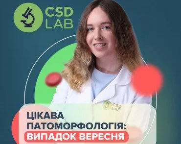 Случай месяца: Муцинозная цистаденокарцинома