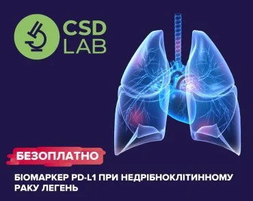 Дослідження експресії біомаркеру PD-L1 при недрібноклітинному раку легень в CSD безоплатно