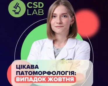 Случай месяца: Коллагенозный колит