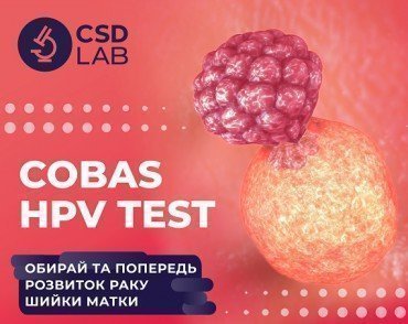 COBAS HPV TEST: Попередьте розвиток раку шийки матки