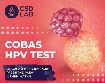 COBAS HPV TEST: Предупредите развитие рака шейки матки