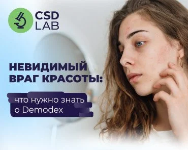 как избавиться от прыщей