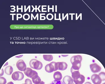  Знижені тромбоцити: про що сигналізує організм?