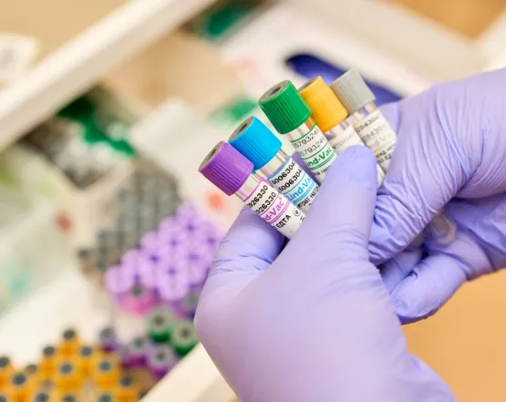 Чи небезпечні коти для вагітних: правда про токсоплазмоз