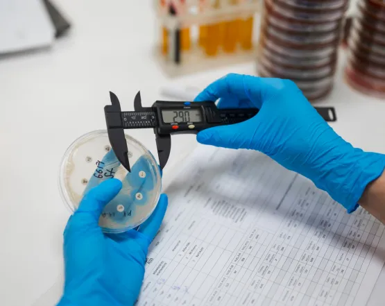 Коли антибіотики перестають працювати: роль лабораторної діагностики у стримуванні резистентності