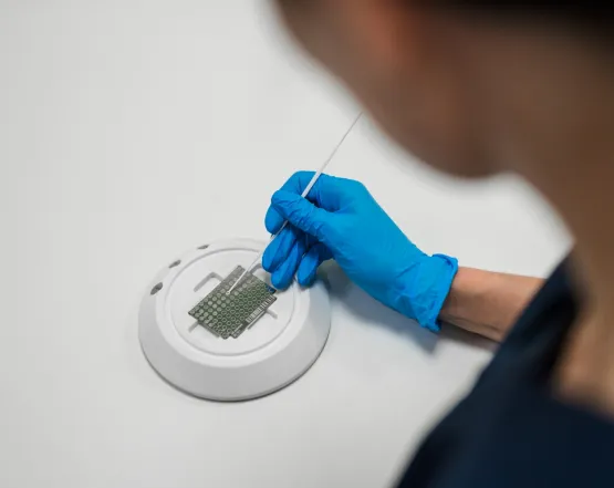 Діагностика оніхомікозів і мікозів стоп у CSD LAB: точність, на яку можуть спиратися подологи