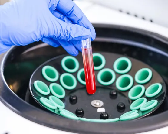 Сезонна застуда: які аналізи варто здати при затяжному кашлі?