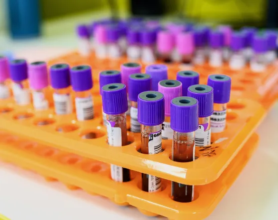 загальний аналіз крові