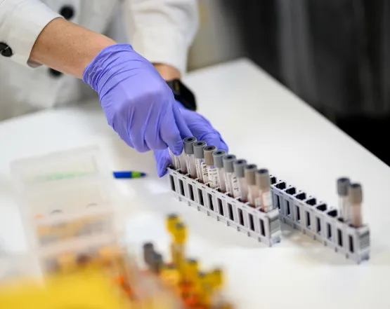 Сучасна діагностика діабету: від перших аналізів до розширених програм у CSD LAB