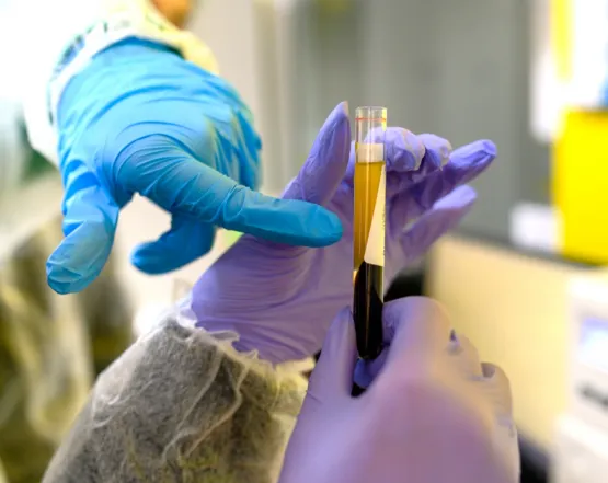 Після свят: які аналізи допоможуть перевірити стан організму?