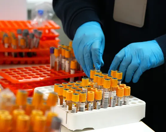 Як підготуватися до здачі аналізів?