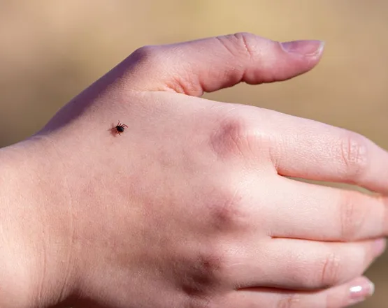 Кліщовий енцефаліт