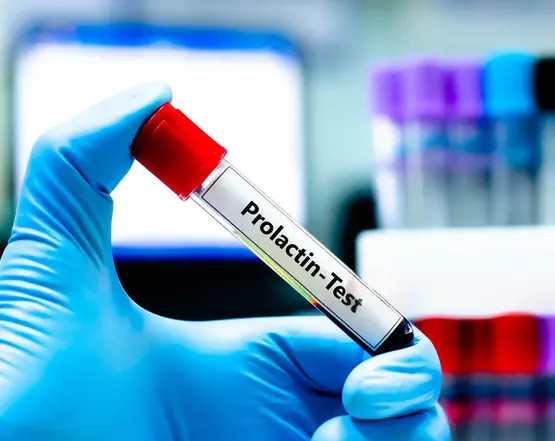 prolactin