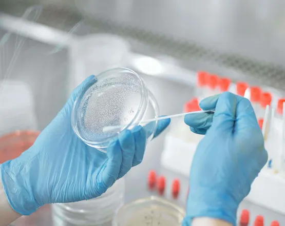 microbiological analyses