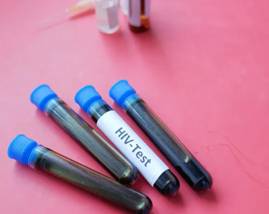 HIV