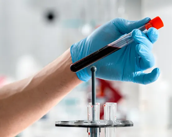 blood testing