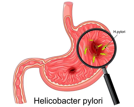 helicobacter