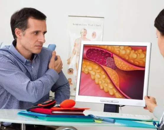 Atherosclerosis