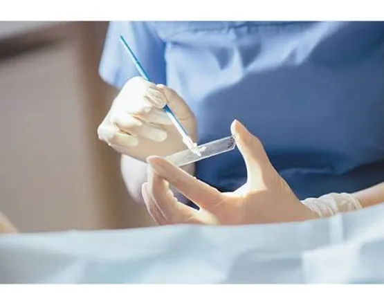 urogenital-smears