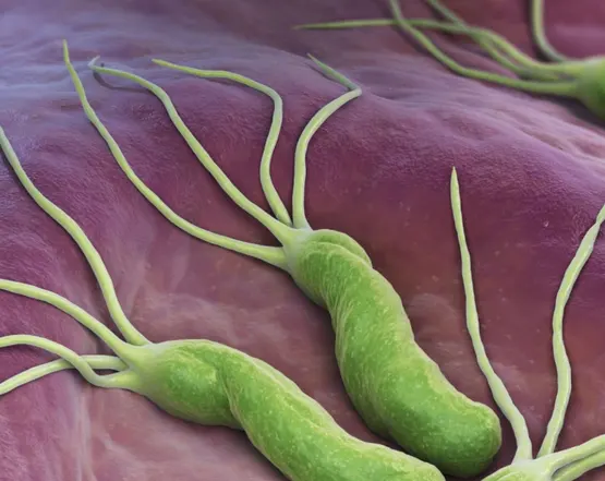 Helicobacter pylori