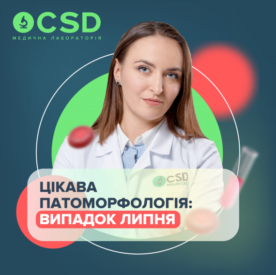 Случай июля: лейомиома с недостаточностью фумарат-гидратазы