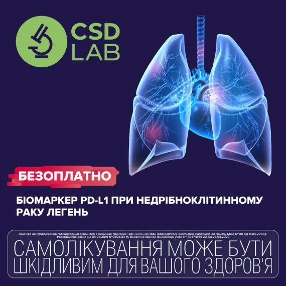 Дослідження експресії біомаркеру PD-L1 при недрібноклітинному раку легень в CSD безоплатно