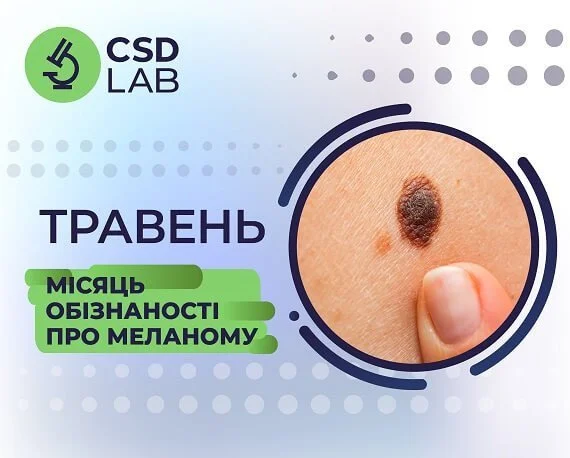 Травень - місяць обізнаності про рак шийки матки Травень - місяць обізнаності про рак шийки матки