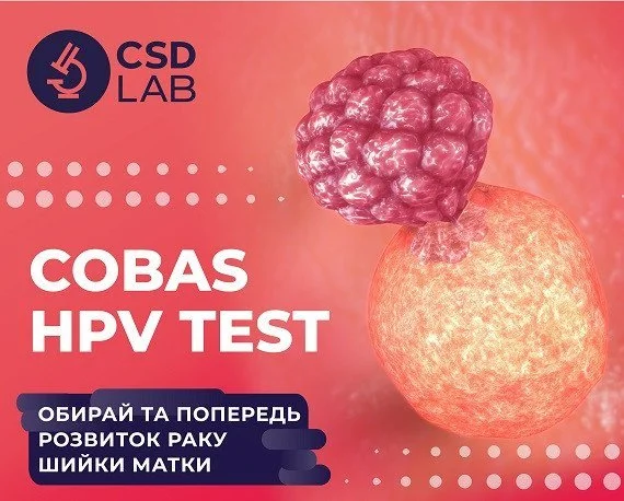 COBAS HPV TEST: Попередьте розвиток раку шийки матки COBAS HPV TEST: Попередьте розвиток раку шийки матки