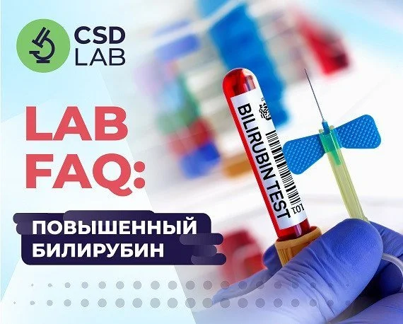 Повышение билирубина: симптомы и причины Повышение билирубина: симптомы и причины