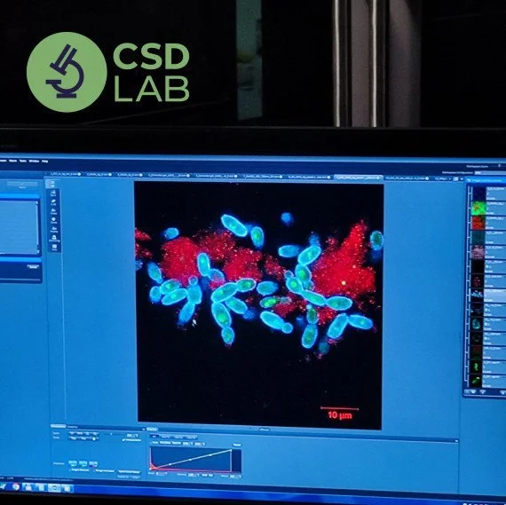 CSD LAB — точність заради життя цитологія