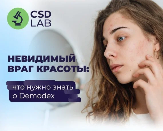 прыщи, прыщ, прищ, проблемная кожа как избавиться от прыщей