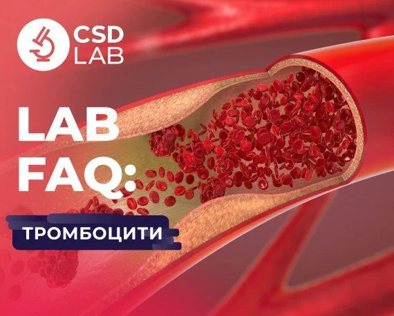 точні аналізи в медичній лабораторії CSD LAB підвищені тромбоцити