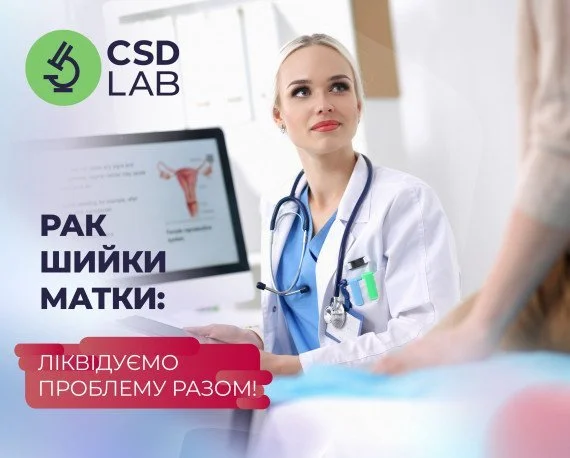 CSD LAB — точність заради життя Рак шийки матки