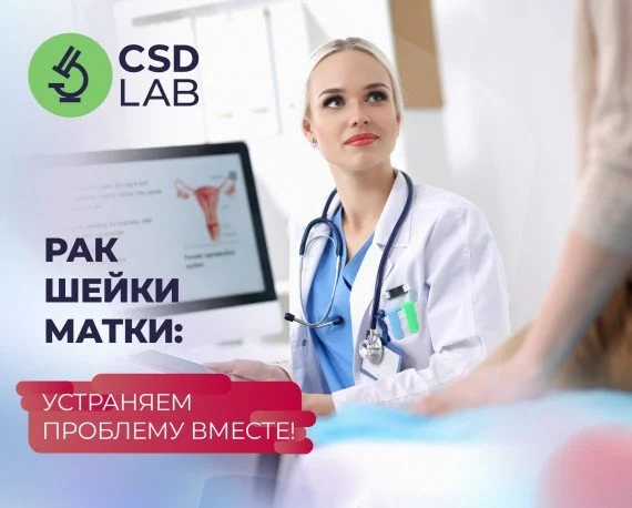 CSD LAB — точность ради жизни Рак шейки матки РШМ