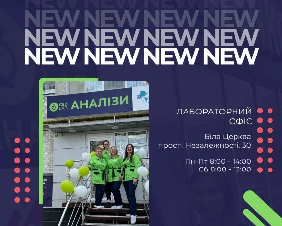 CSD LAB Біла Церка мадична лабораторія аналізи в Білій Церкві
