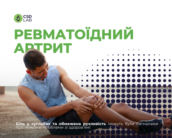 ревматоїдний артрит чоловік тримається за коліно