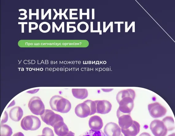 Знижені тромбоцити: про що сигналізує організм?
