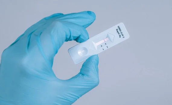Швидке виявлення антигенів SARS-CoV-2