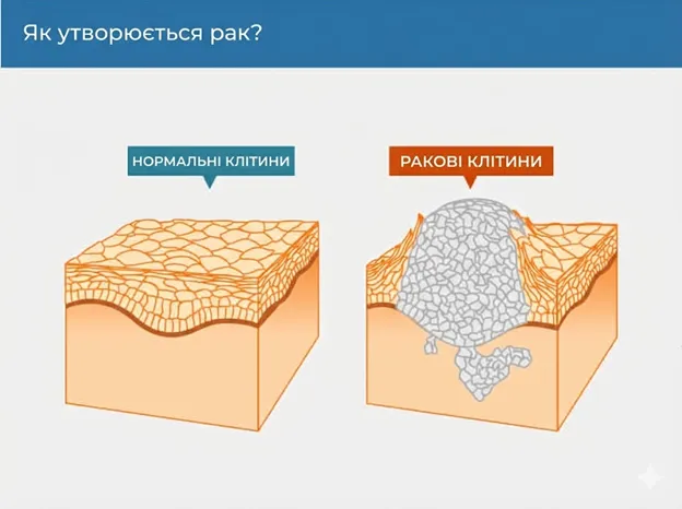 Що таке рак і як він виникає?
