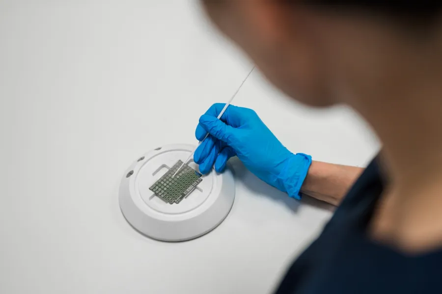 Діагностика оніхомікозів і мікозів стоп у CSD LAB: точність, на яку можуть спиратися подологи