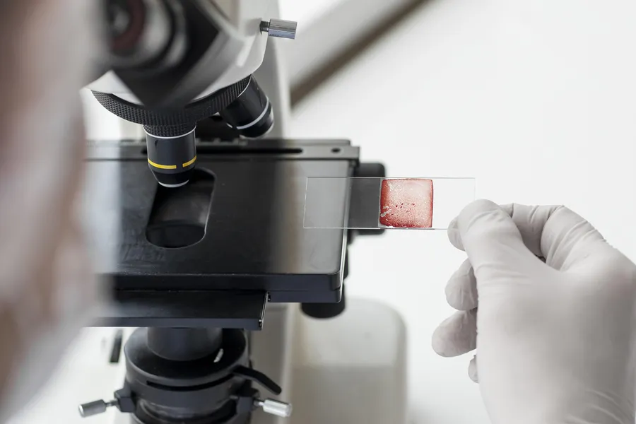 Як часто потрібно здавати ПАП-тест: усе, що варто знати про сучасний скринінг РШМ