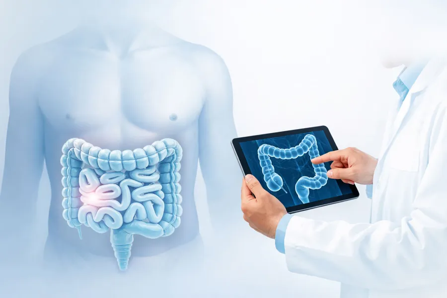 Чому колоректальний рак називають «тихою загрозою» і як генетичне тестування може врятувати ваше життя?