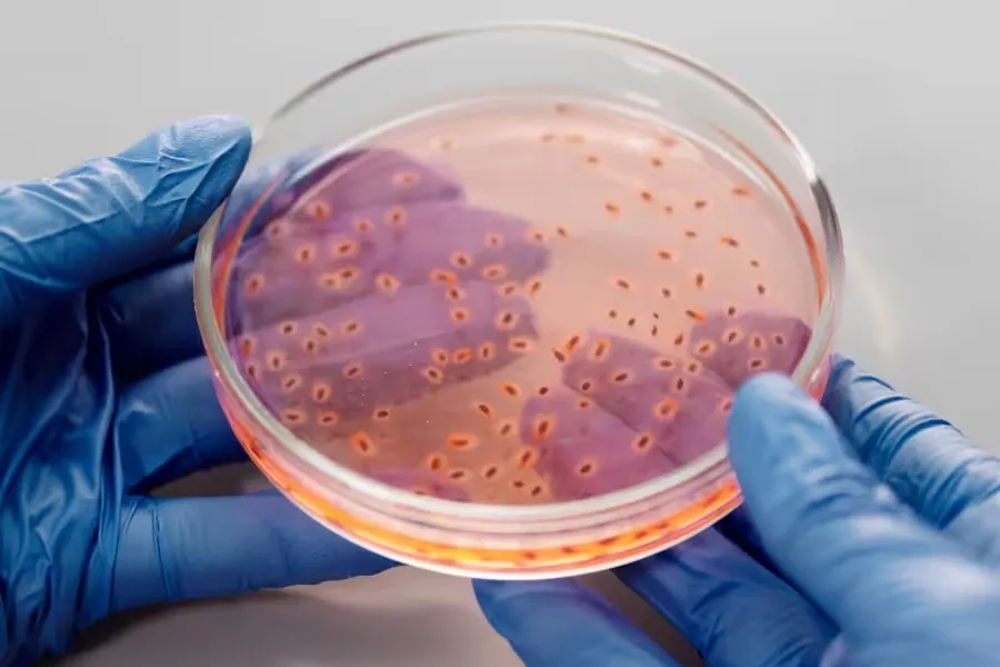 Антибіотикорезистентні бактерії: що означають MRSA, ESBL, VRE та карбапенемази