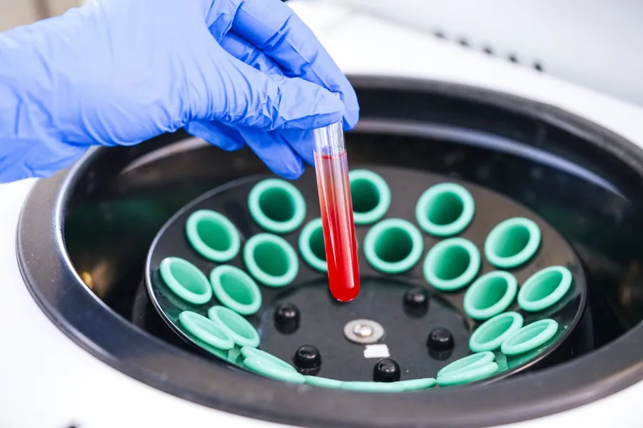 Сезонна застуда: які аналізи варто здати при затяжному кашлі?