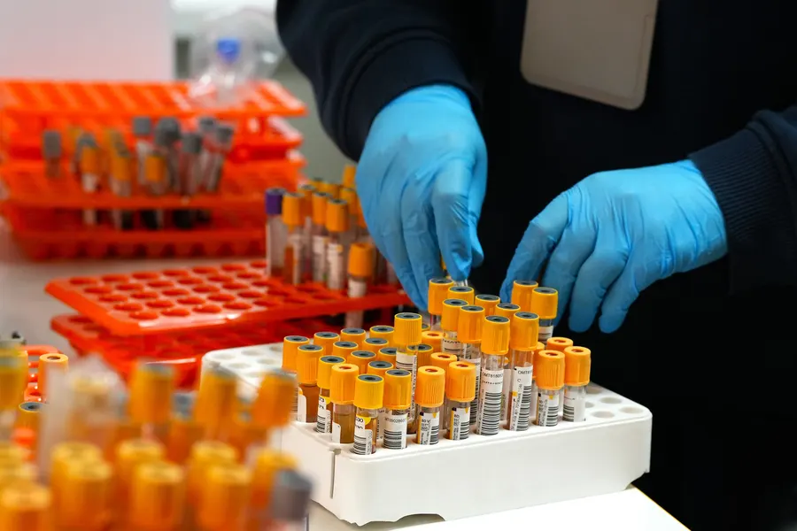 Як підготуватися до здачі аналізів?