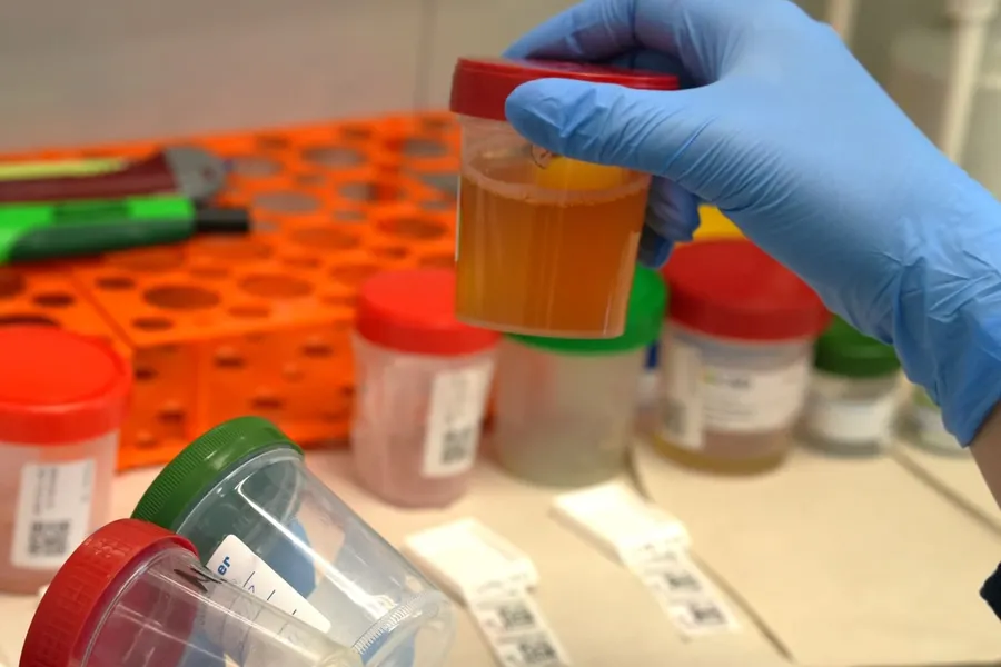 Інфекції сечовивідних шляхів (ІСШ): що потрібно знати? 